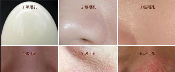 摆脱毛孔粗大的烦恼（独家方法助您拥有细致无瑕的肌肤）