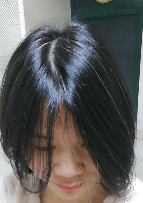 少年白怎么办能恢复（探索少年白恢复的有效方法）