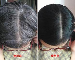 少年白怎么办能恢复（探索少年白恢复的有效方法）