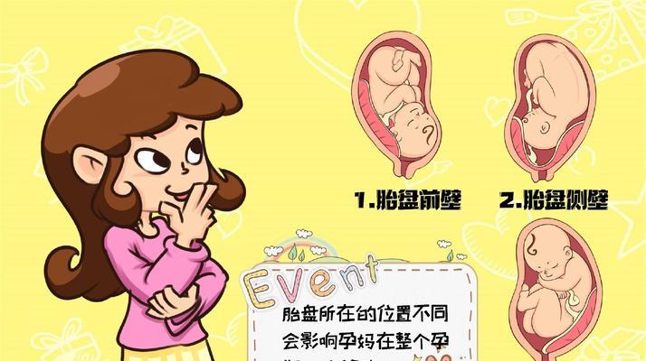 胎位不正纠正的方法与注意事项（为宝宝正确落座）