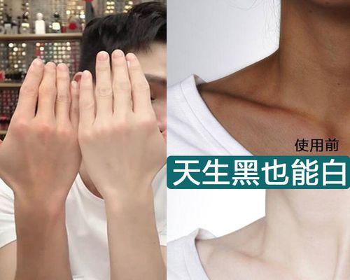 晒黑后如何修复皮肤？有效修复晒伤的步骤和建议是什么？