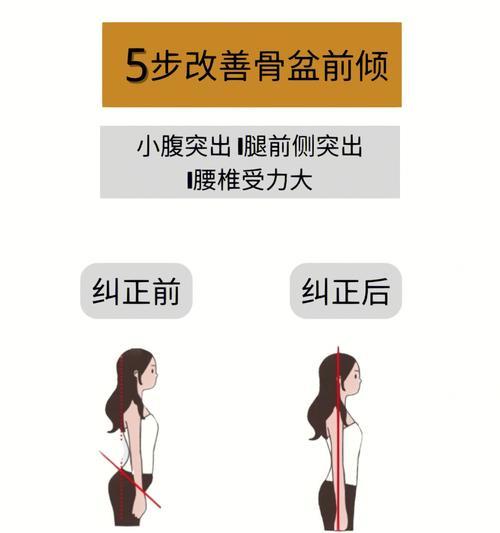 骨盆前倾最快纠正法是什么？如何快速有效地进行纠正？