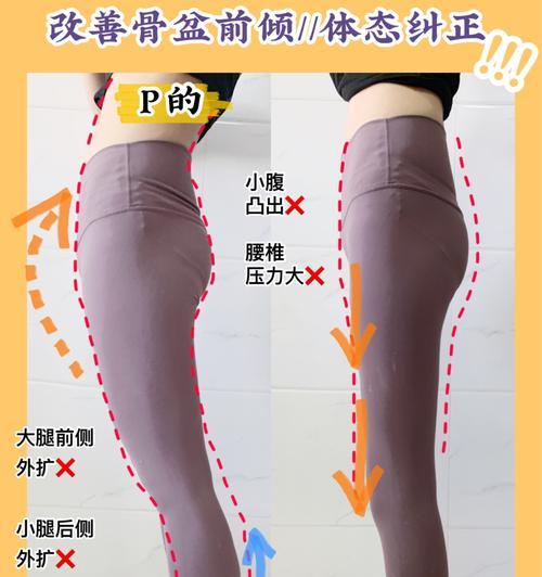 骨盆前倾最快纠正法是什么？如何快速有效地进行纠正？