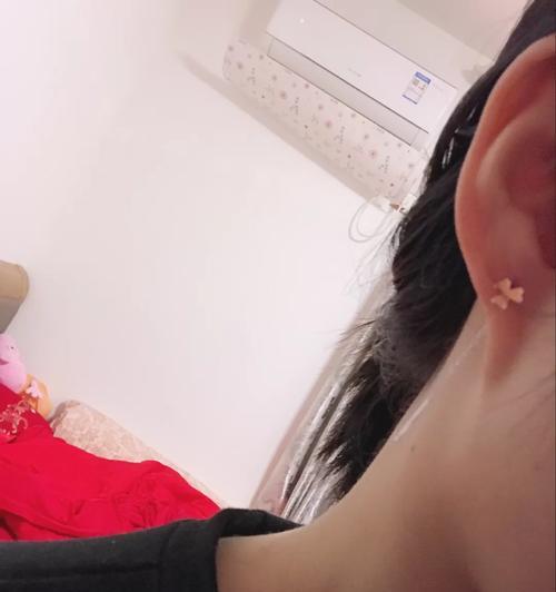怎么用手机给自己耳朵拍照？拍照时耳朵为何模糊不清？