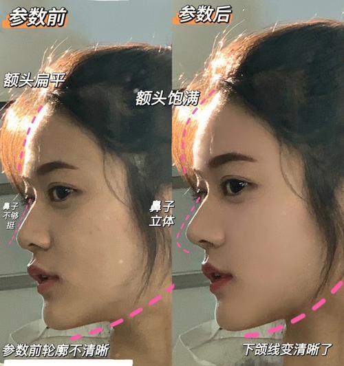 手机侧脸拍照技巧是什么？如何拍出更好的侧脸照片？