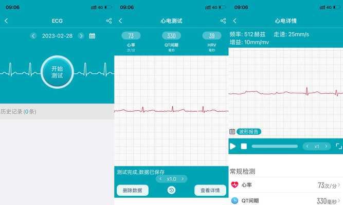 智能手表心电图监测怎么看？心电图监测的解读方法是什么？