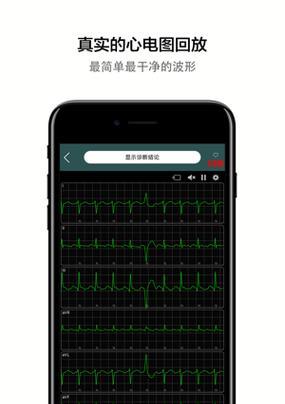 苹果心电图如何显示在手机上？心电图数据同步的步骤是什么？