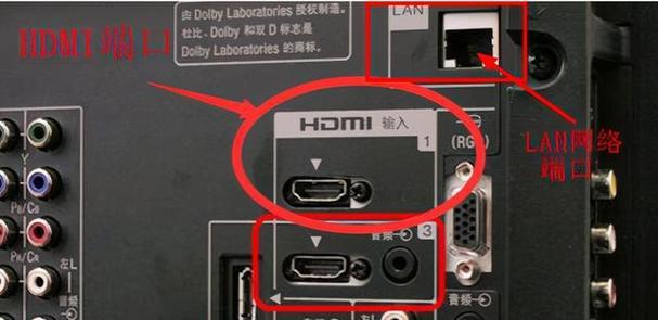 宽带送的网络机顶盒安装方法是什么？步骤是什么？