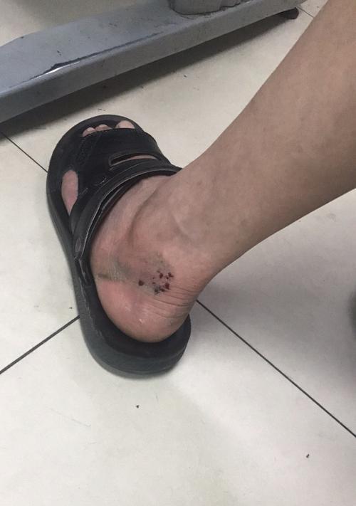 电瓶车摔了应该怎么办？如何快速恢复使用？